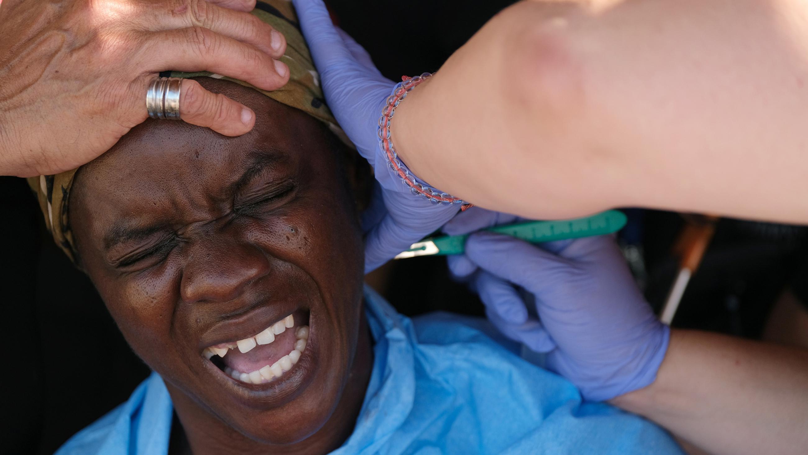 Picture shows a woman who is having a surgery done on her neck. She appears to be in excruciating pain. 