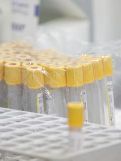 The photo shows a set of vials with yellow tops in a rack, unopened and covered in plastic. In front is a single tube that appears to have been used. 