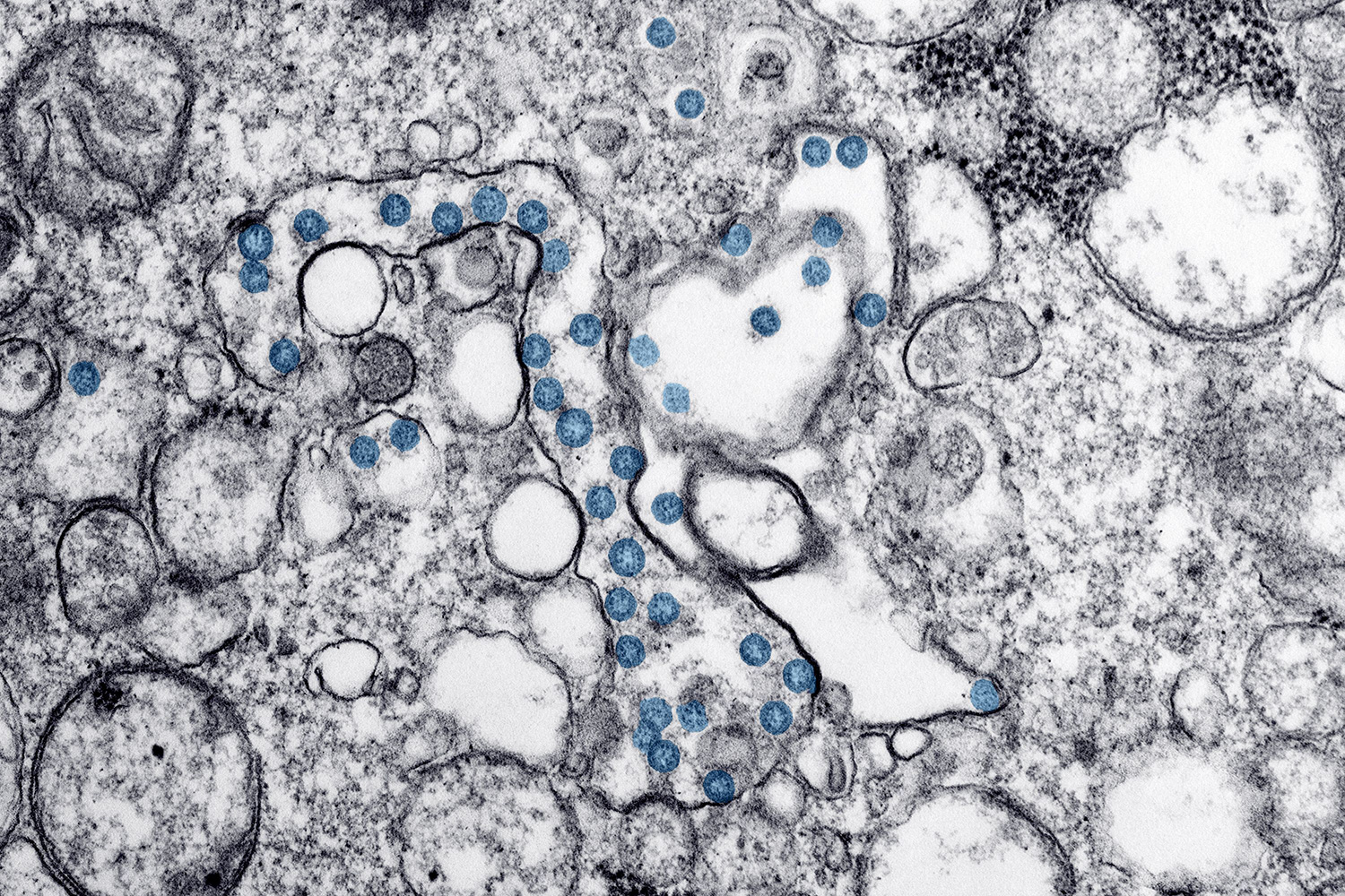 The image is a micrograph showing tissue/cell samples.