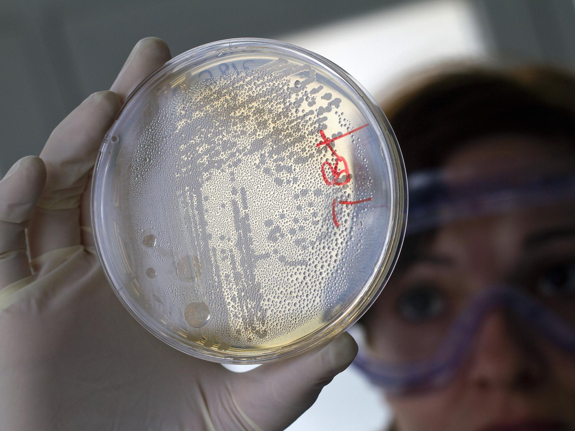 A laboratory worker looks for strains of E.coli bacteria in vegetable cells placed in a petri dish, in La Mojonera, Spain, on June 2, 2011