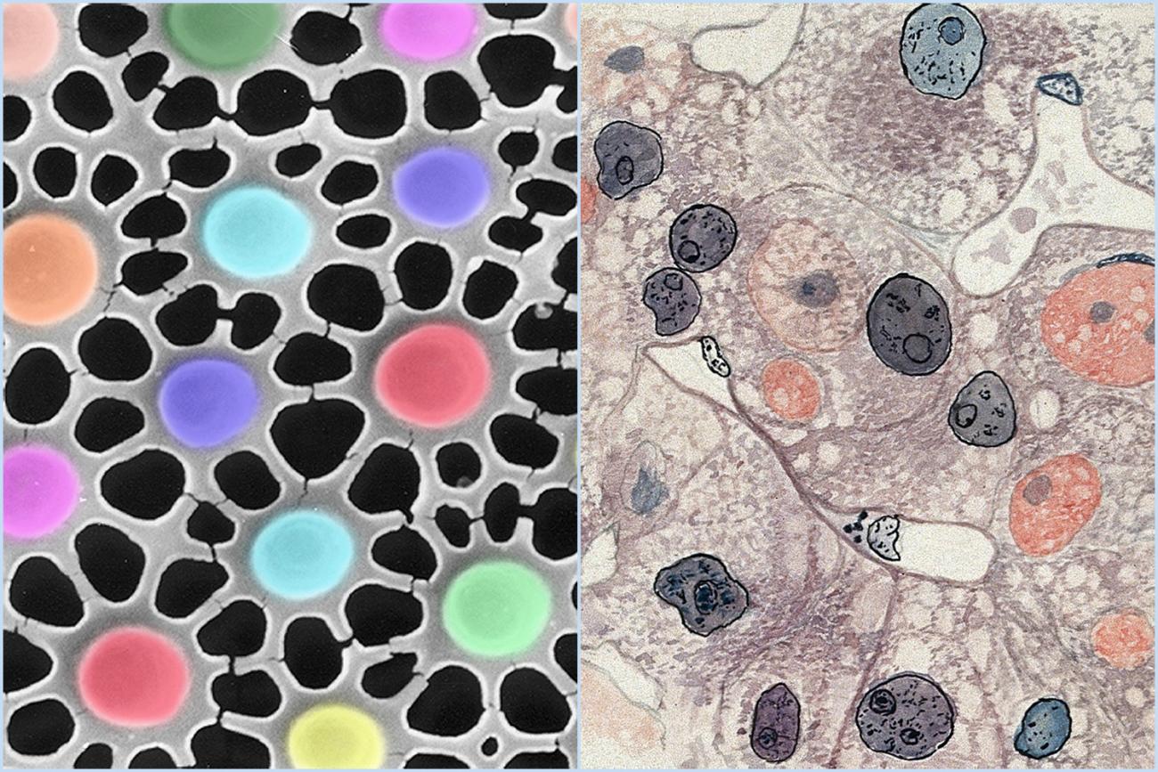 The photo shows two images with pastel-colored highlights that seem almost more artistic than scientific.