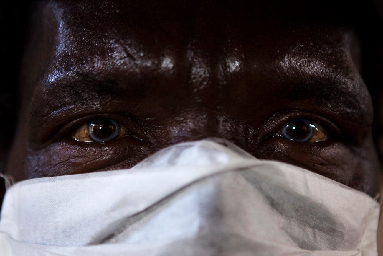 The photo is a close up of the patient's face with only the eyes and sweat-covered brow visible over a mask.