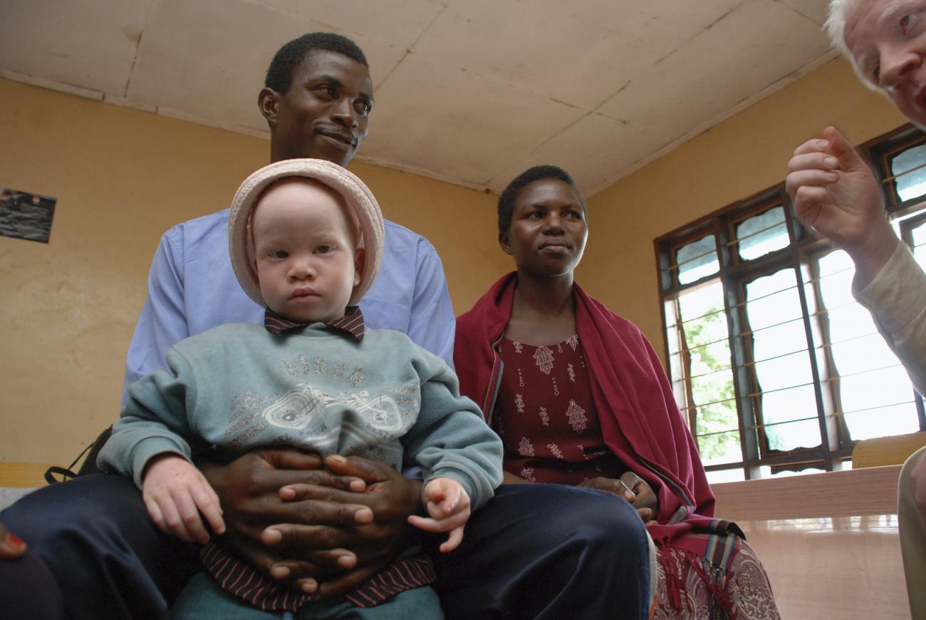The father of a toddler with albinism hold his son on his lap as he sits next to his wife. The family listens to information about their child's health and education options from a man who is partially cropped out of the picture.