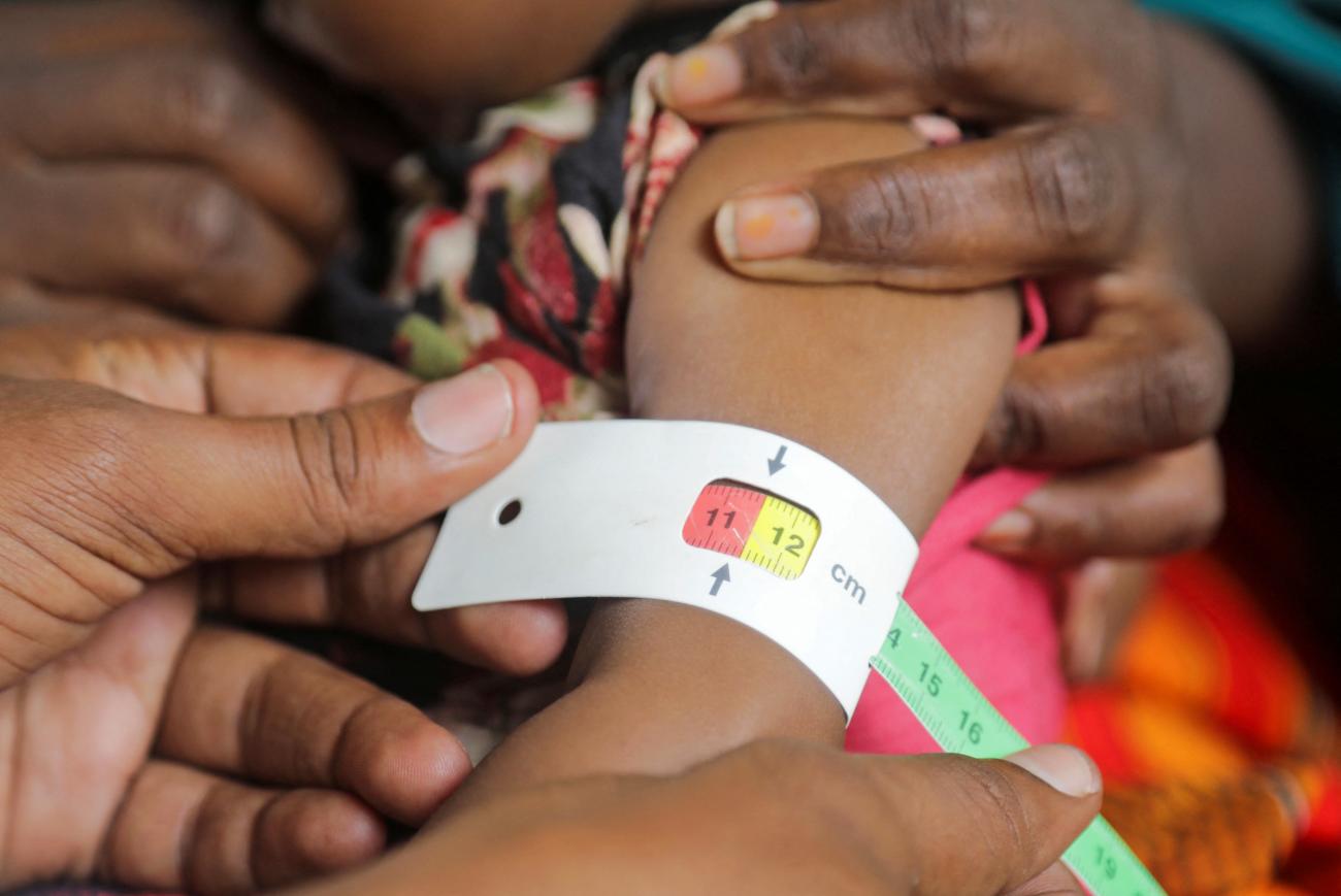 A Somali displaced woman holds her one-year-old child Hassan Mukhtar Mohamed as he is screened for malnutrition.