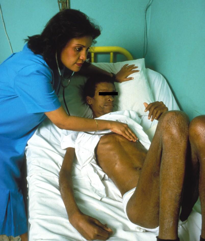 Marie-Marcelle Deschamps is seen treating an AIDS patient, prior to the disease being defined, in Haiti, in 1984.