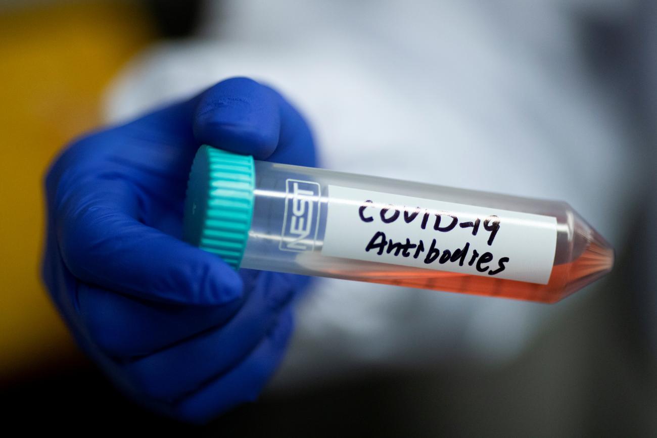 Scientist Linqi Zhang shows a tube with a solution containing COVID-19 antibodies in his lab at Tsinghua University's Research Center for Public Health.