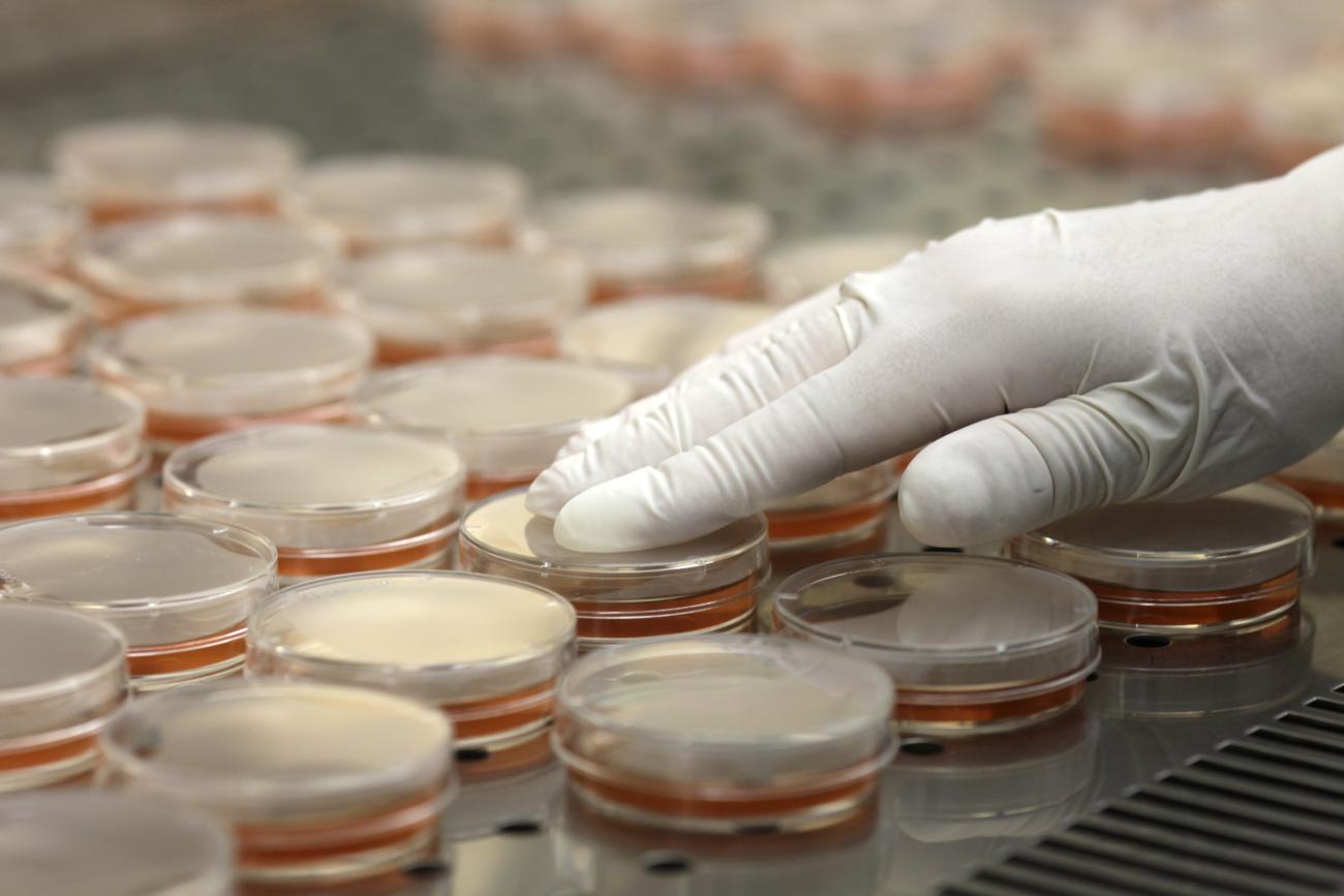 A specialist arranges petri dishes at the Institute of Food Safety, Animal Health and Environment, in Riga, Latvia, on June 9, 2011. 