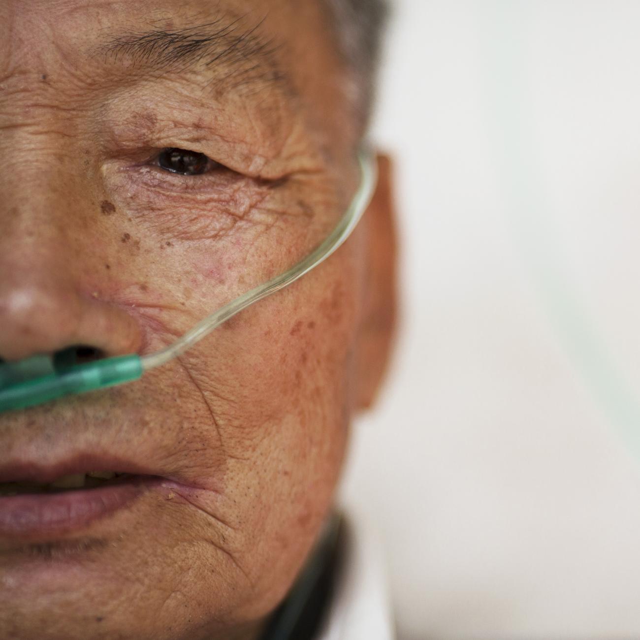 A close-up photo of the face of Hu Hushen, a 78-year-old former miner, who breathes with the help of extra oxygen at Yangjia Hospital in Zhejiang Province, China, on October 19, 2015.