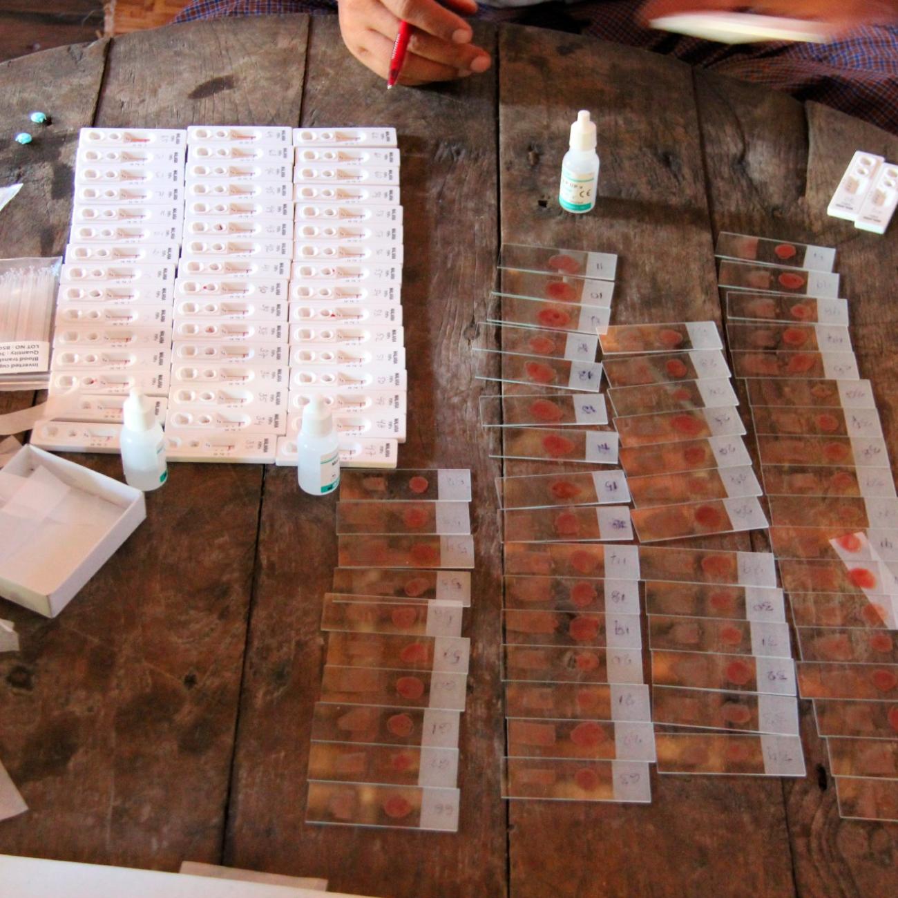 malaria tests