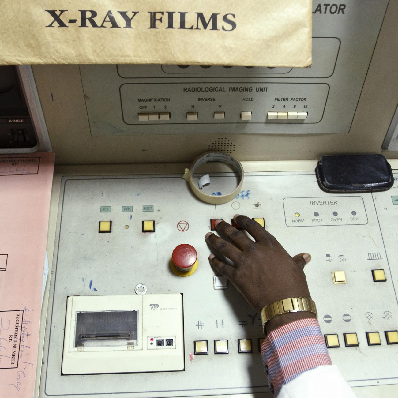 Radiotherapist Enock Okine operates a radiotherapy simulator at the Korle Bu Teaching Hospital in Accra April 24, 2012.