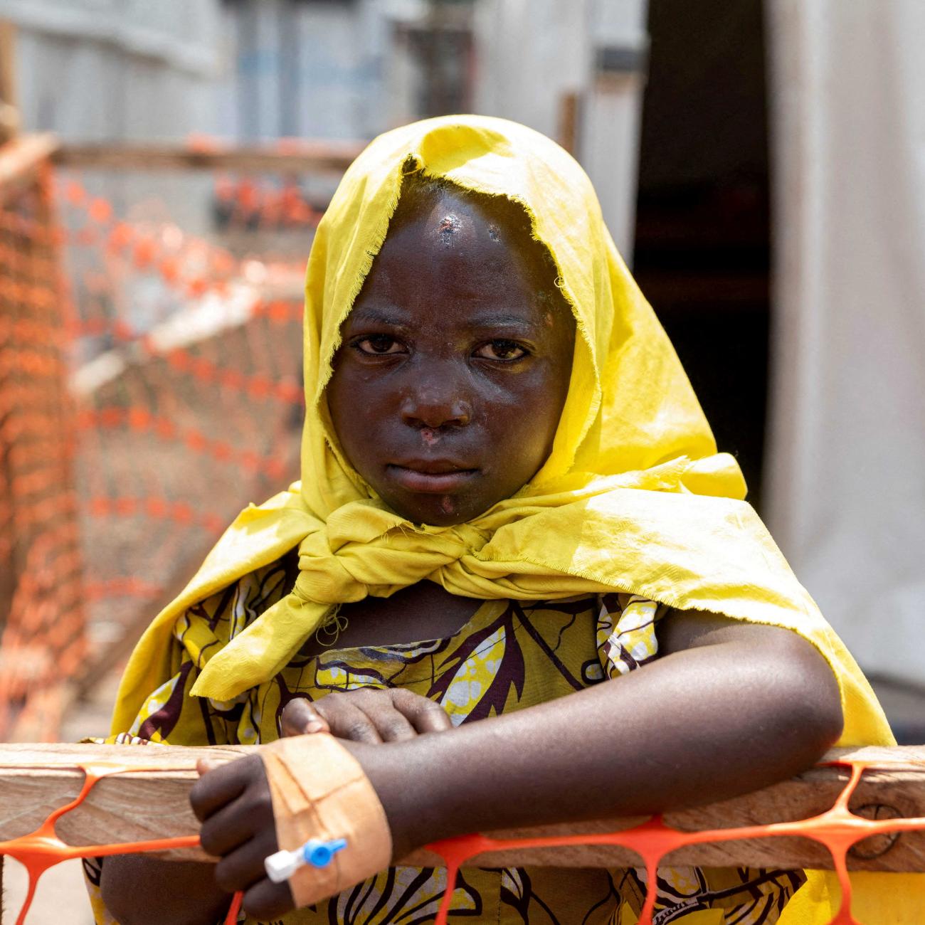A newly arrived patient awaits a consultation at the treatment center for mpox.