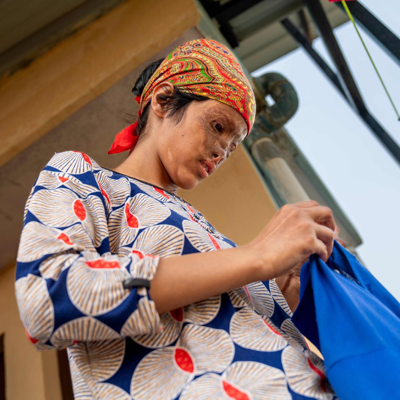 Rajkumari, a 17-year-old epilepsy and burn patient, holds a shirt.