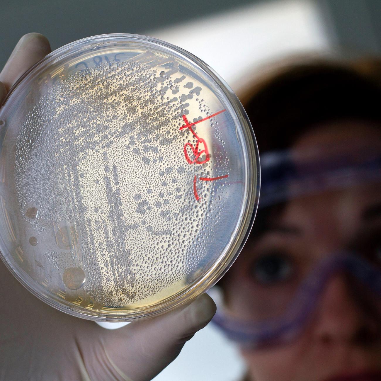 A laboratory worker looks for strains of E.coli bacteria in vegetable cells placed in a petri dish, in La Mojonera, Spain, on June 2, 2011.