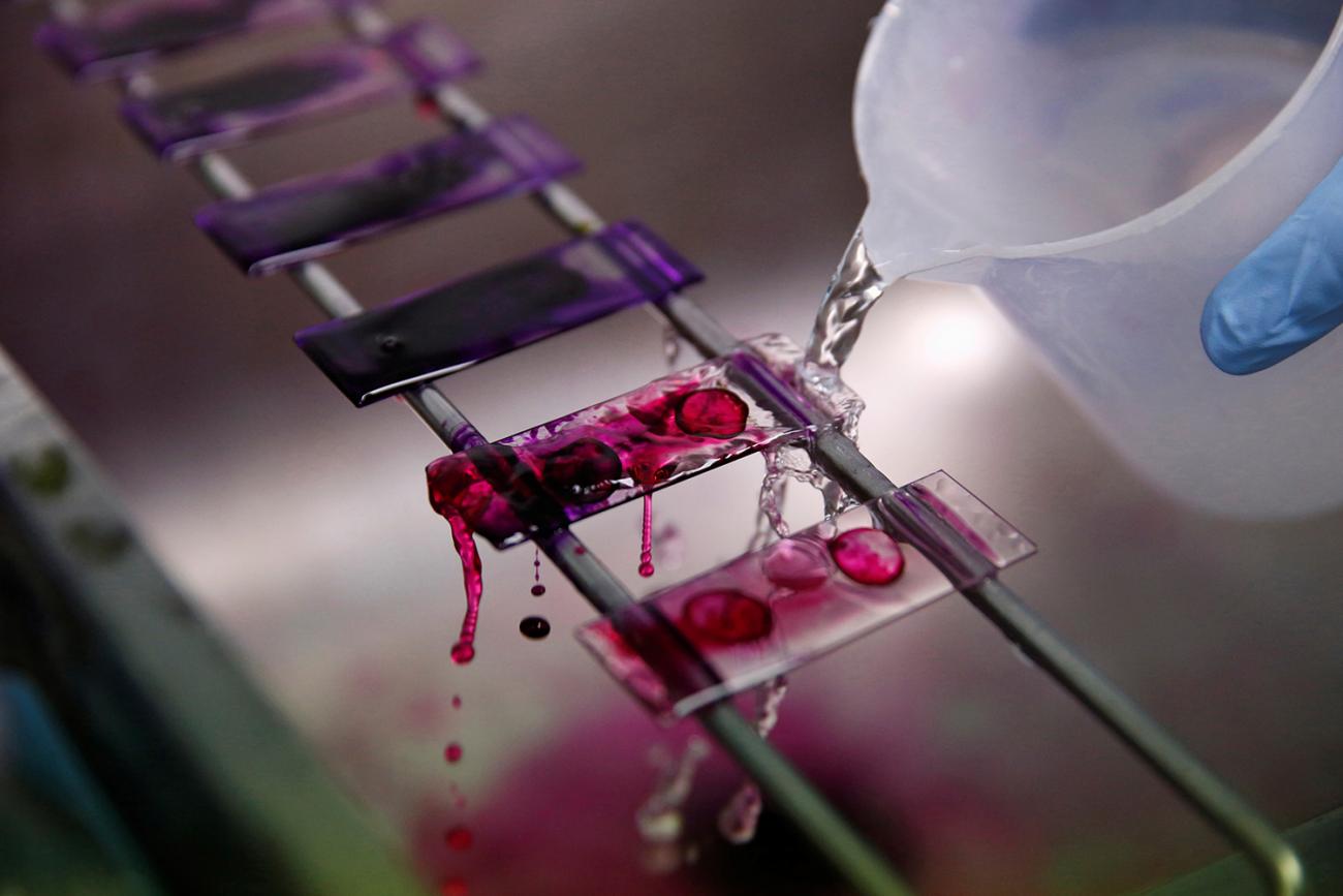 A health technician analyses blood samples for tuberculosis testing in a high-tech TB laboratory in Carabayllo, an area in Lima, Peru on May 19, 2016. The image shows a splashing liquid being washed across glass plates each of which is dotted with what appears to be a blood drop sample. REUTERS/Mariana Bazo