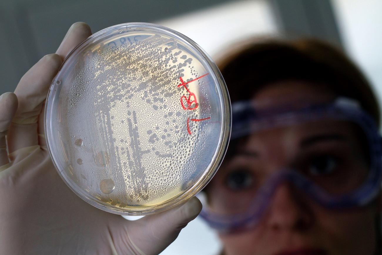 A laboratory worker looks for strains of E. coli bacteria in vegetable cells placed in a petri dish.