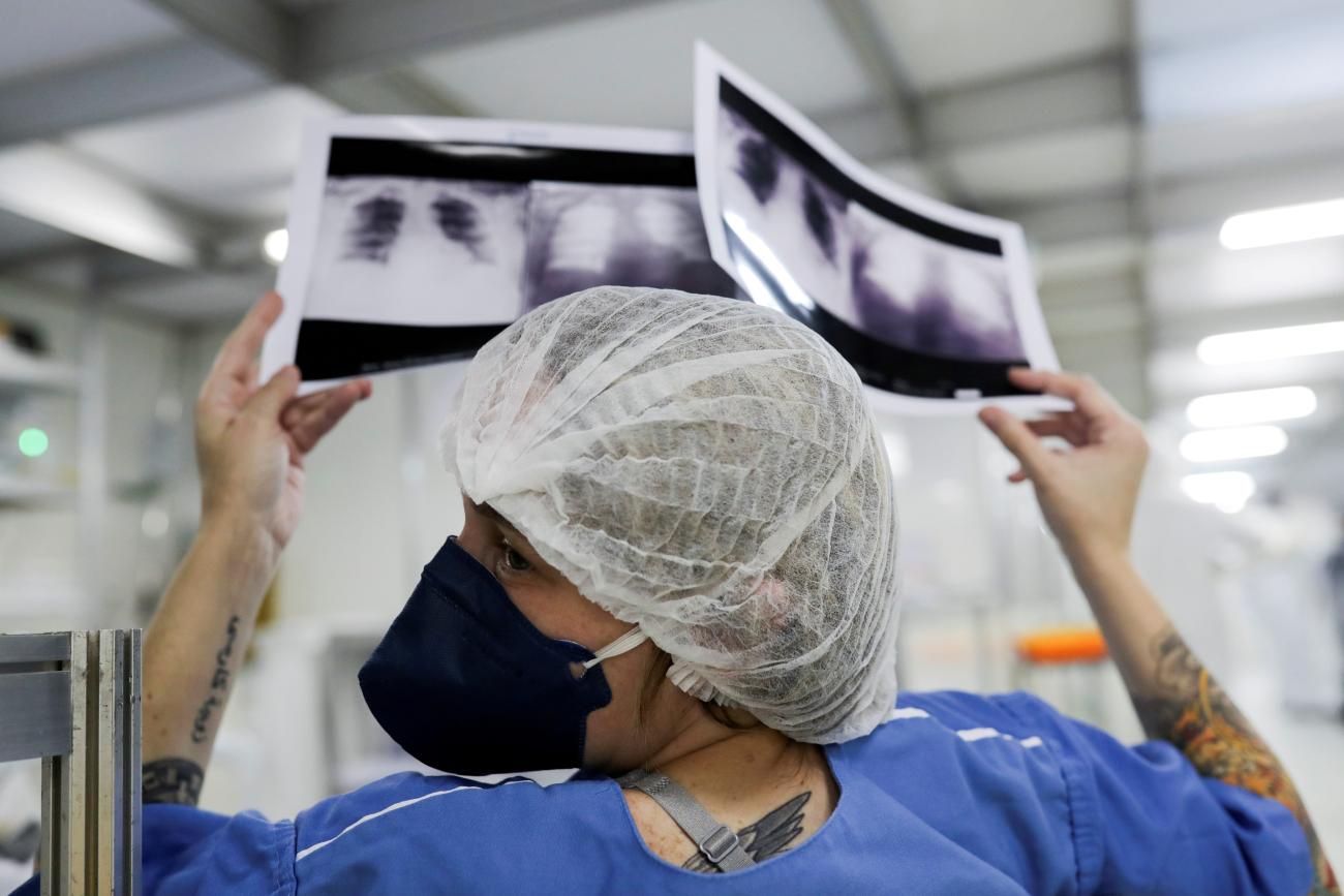 Luciana Souza, MD, compares two different chest x-rays of a patient as she talks to a colleague at a field hospital set up to treat COVID-19 patients.