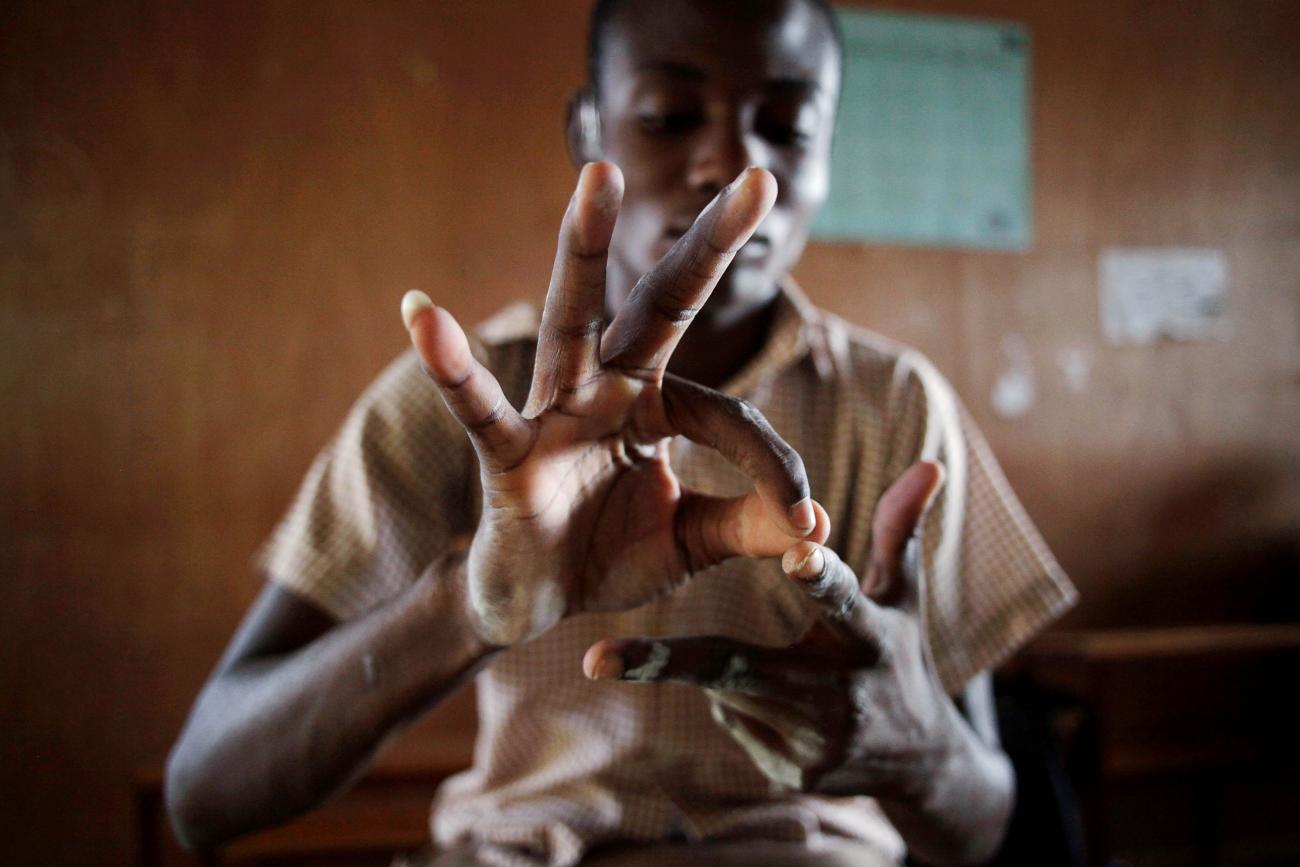 A deaf student counts numbers with his hands at the Mission de L'Espoir school, in Leveque, Haiti, on April 11, 2016.