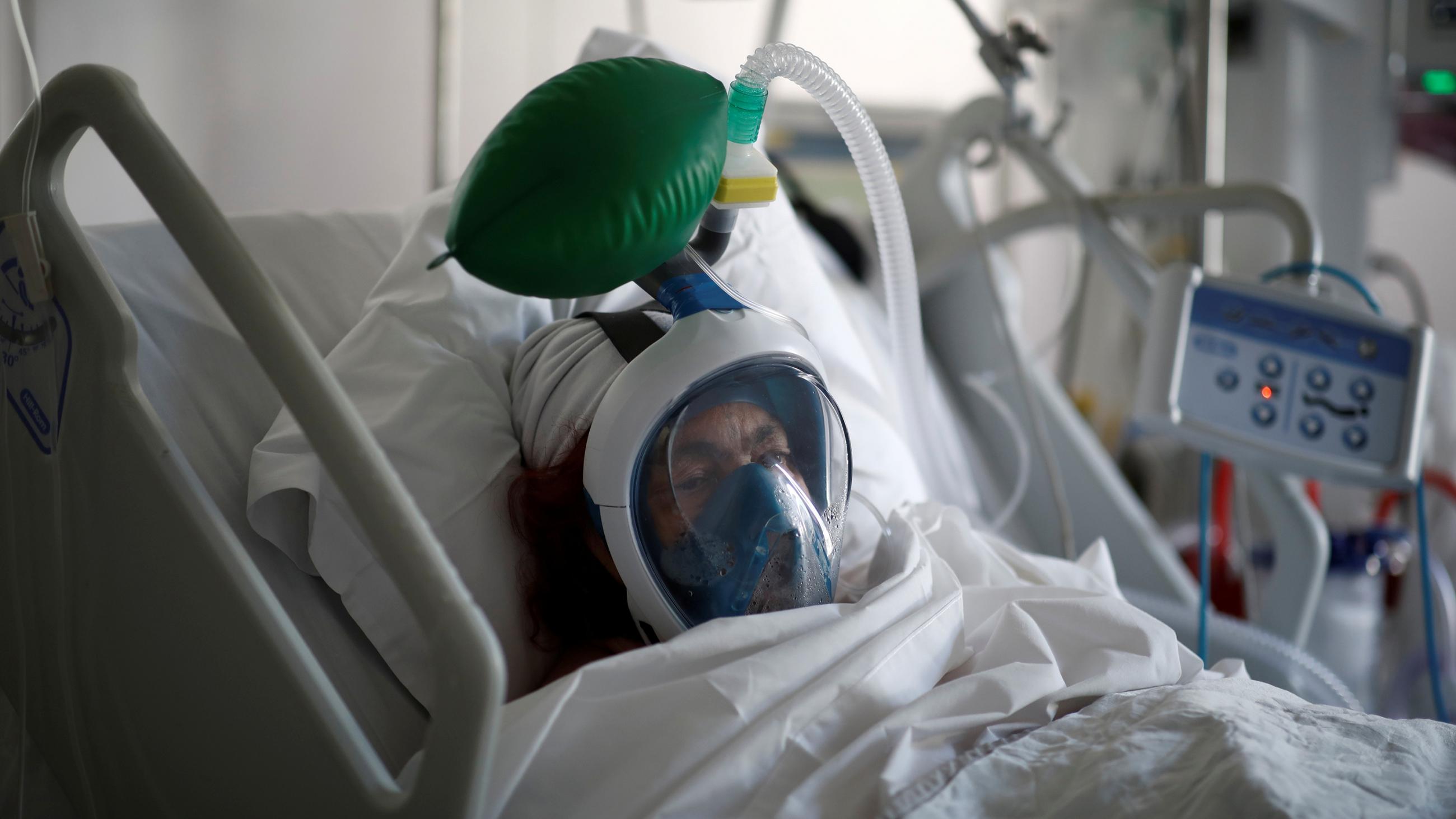 Picture shows a patient in a critical care bed on a ventilator.