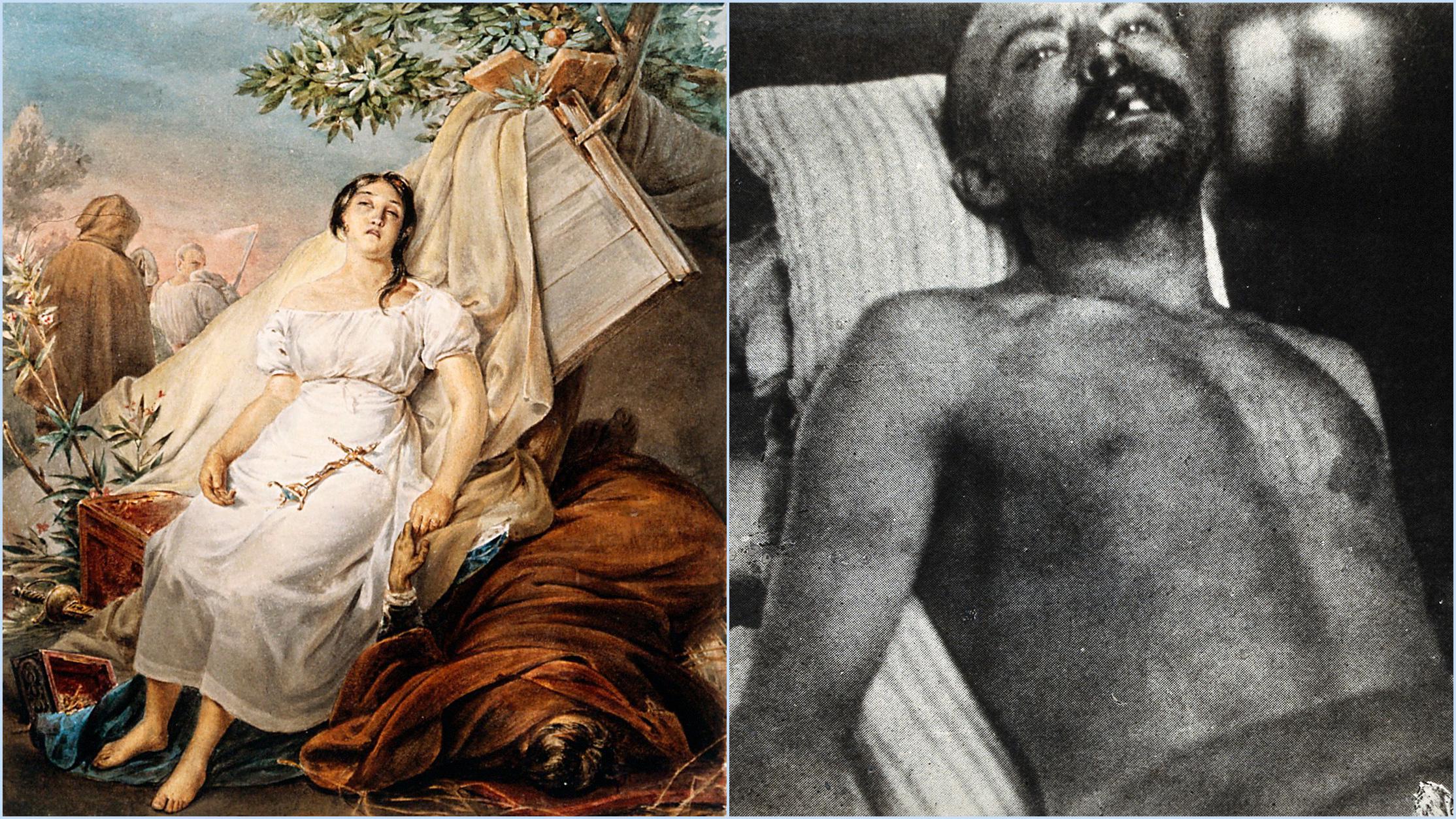 The image is a split screen showing a colorful watercolor in the left panel of a girl and a man in a bed in the right panel. They both have the same tilt to their head and faraway look on their face.