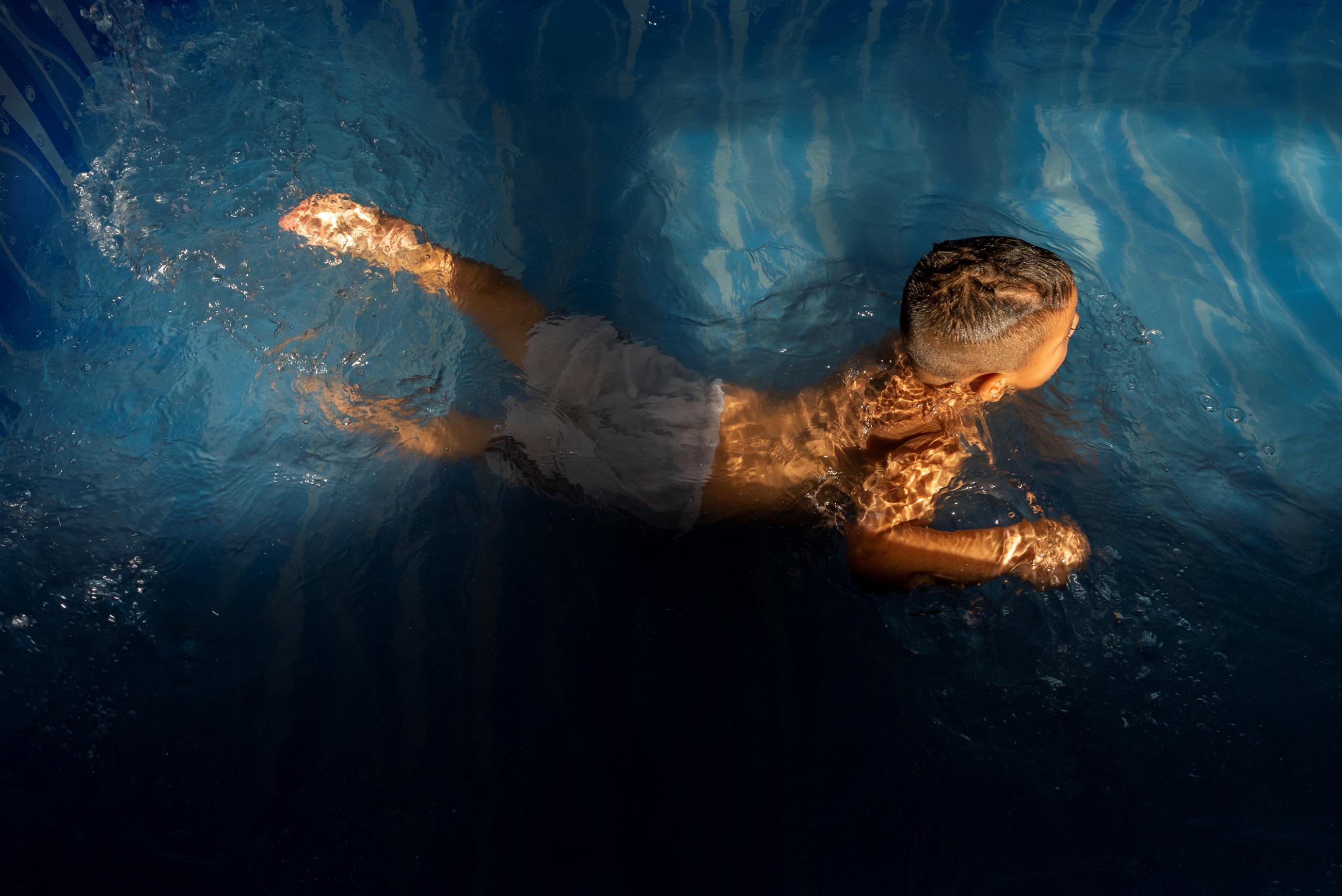 A little boy with closely-cropped hair plays in an aqua-blue swimming pool in a neighborhood of Buenos Aires, Argentina experiencing a spike in tuberculosis cases on January 26, 2019. 