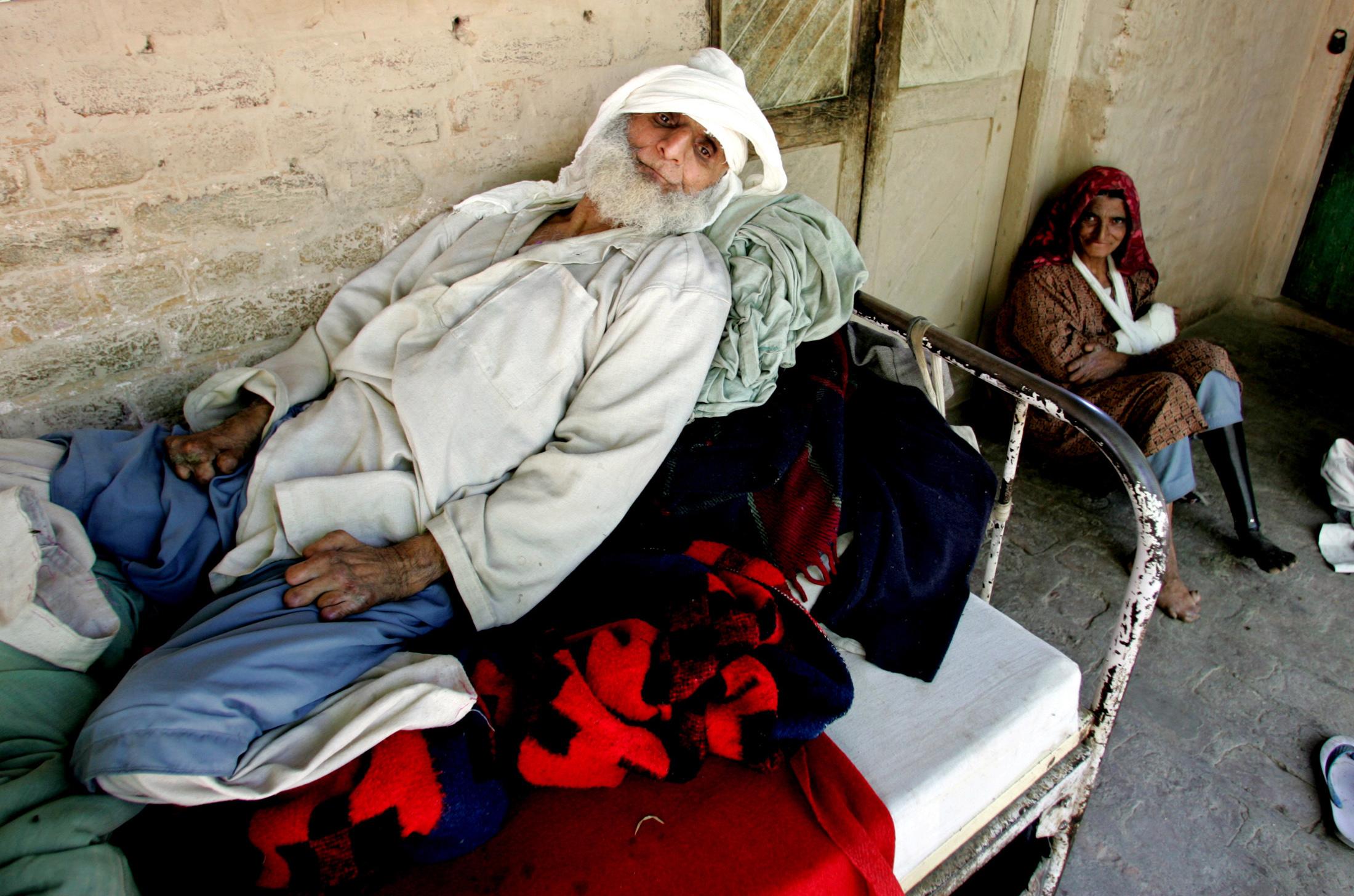 Leprosy patient Fath Choopan rests on a bed at a leprosy home in Nigeen on the outskirts of Srinagar, India, on September 16, 2005. Choopan and other patients are treated like untouchables.
