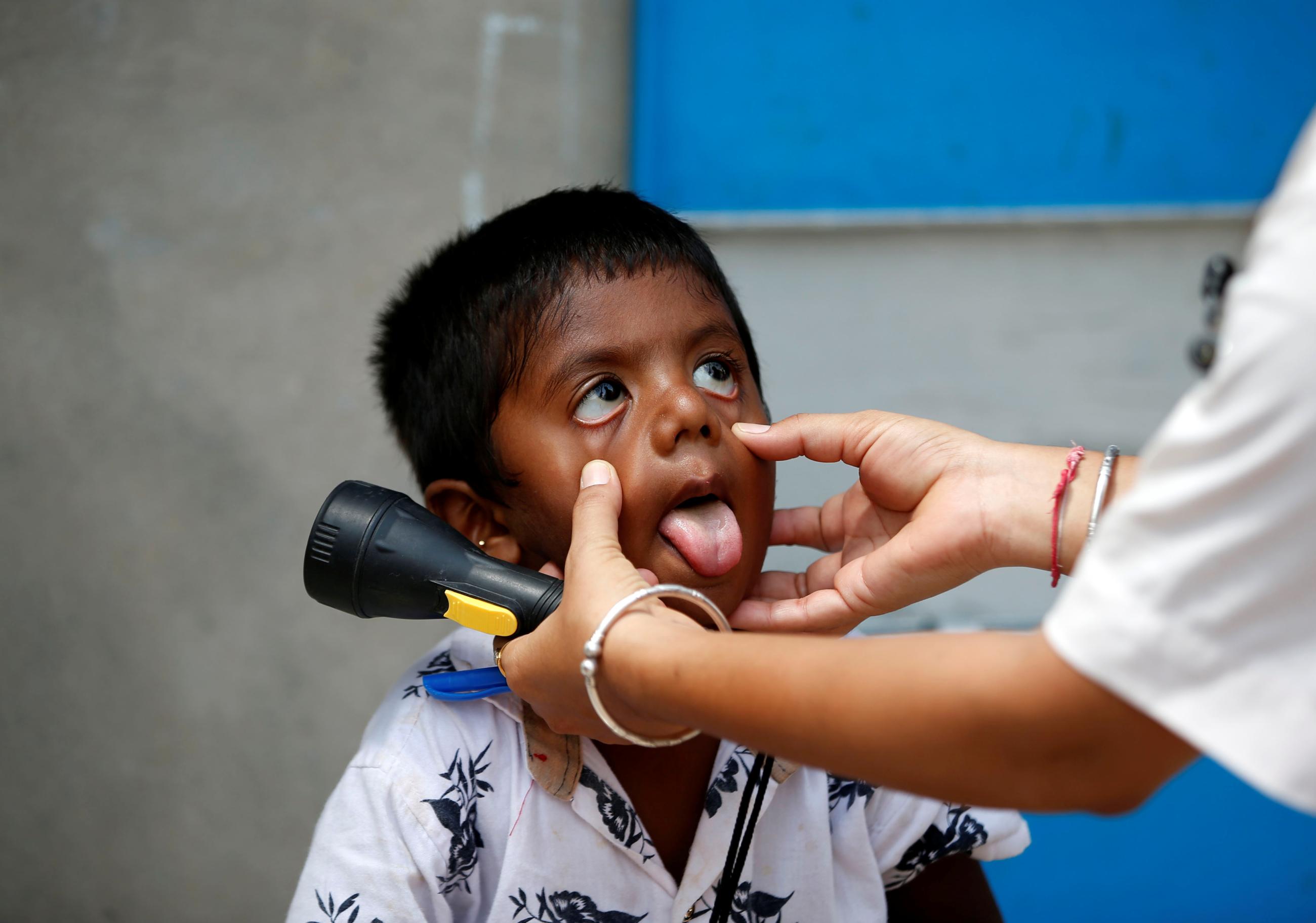 A health-care worker examines a child.