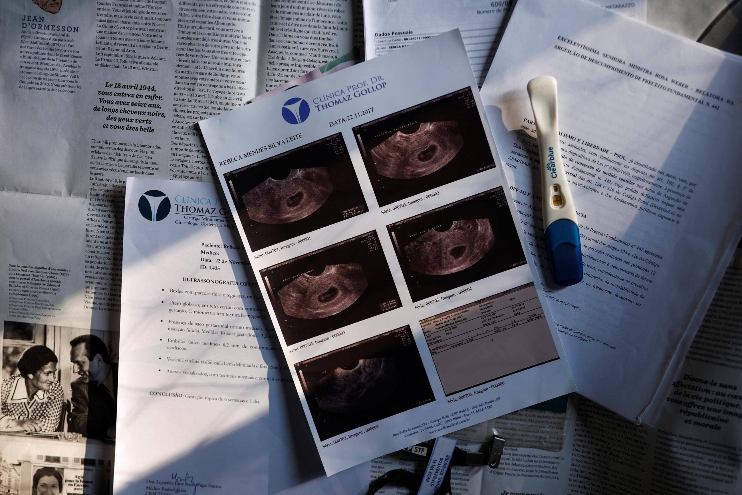 Rebeca Mendes’ ultrasound and pregnancy test reports lie on her bed. She is the first Brazilian woman to demand a legal abortion in the country, in Sao Paulo, Brazil, on July 10, 2024.