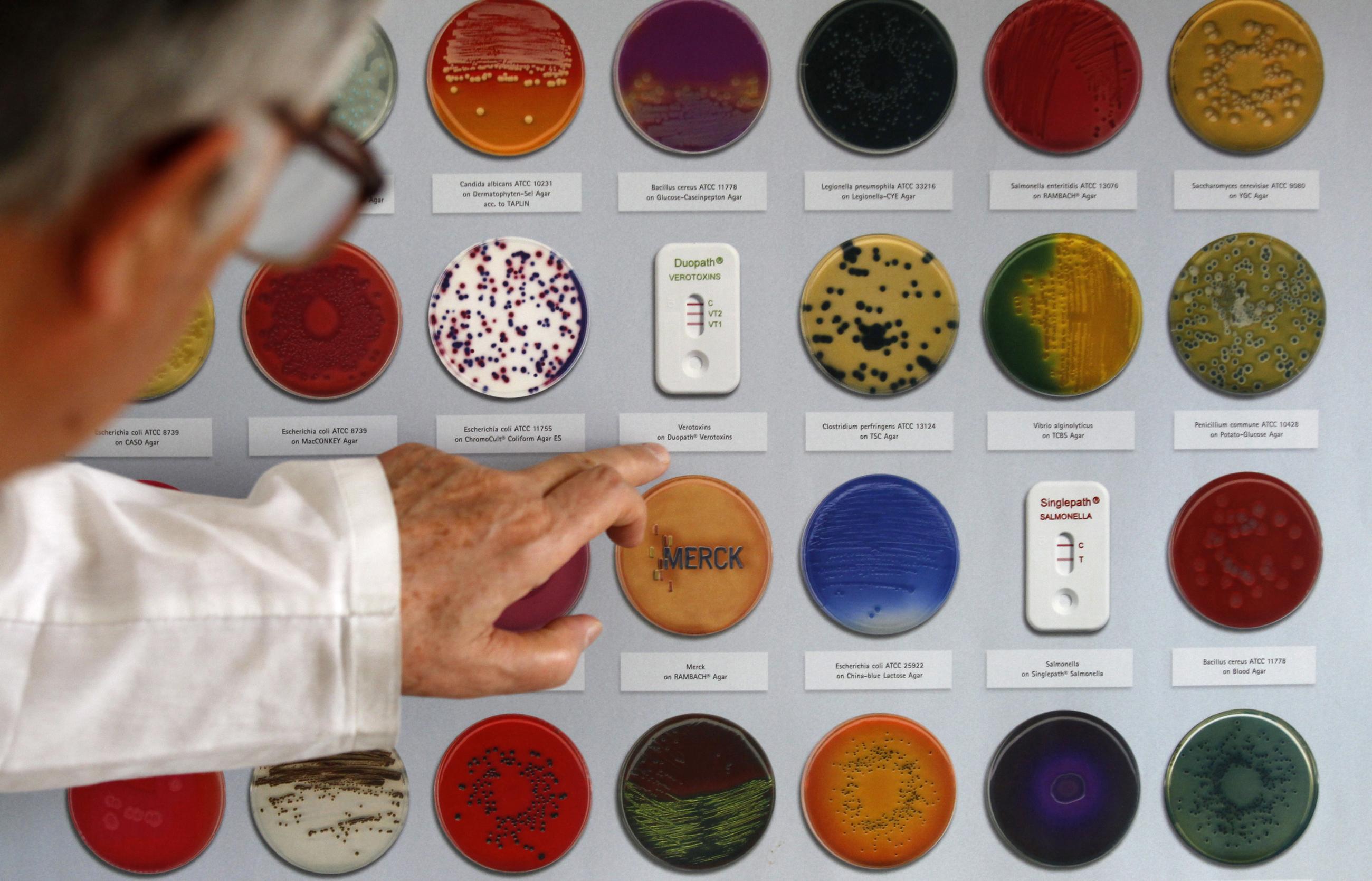 A graph showing examples of a bacterial growth mediums are displayed in a microbiological laboratory at the Bulgarian Food Safety Agency, in Sofia, Bulgaria, on June 9, 2011. 