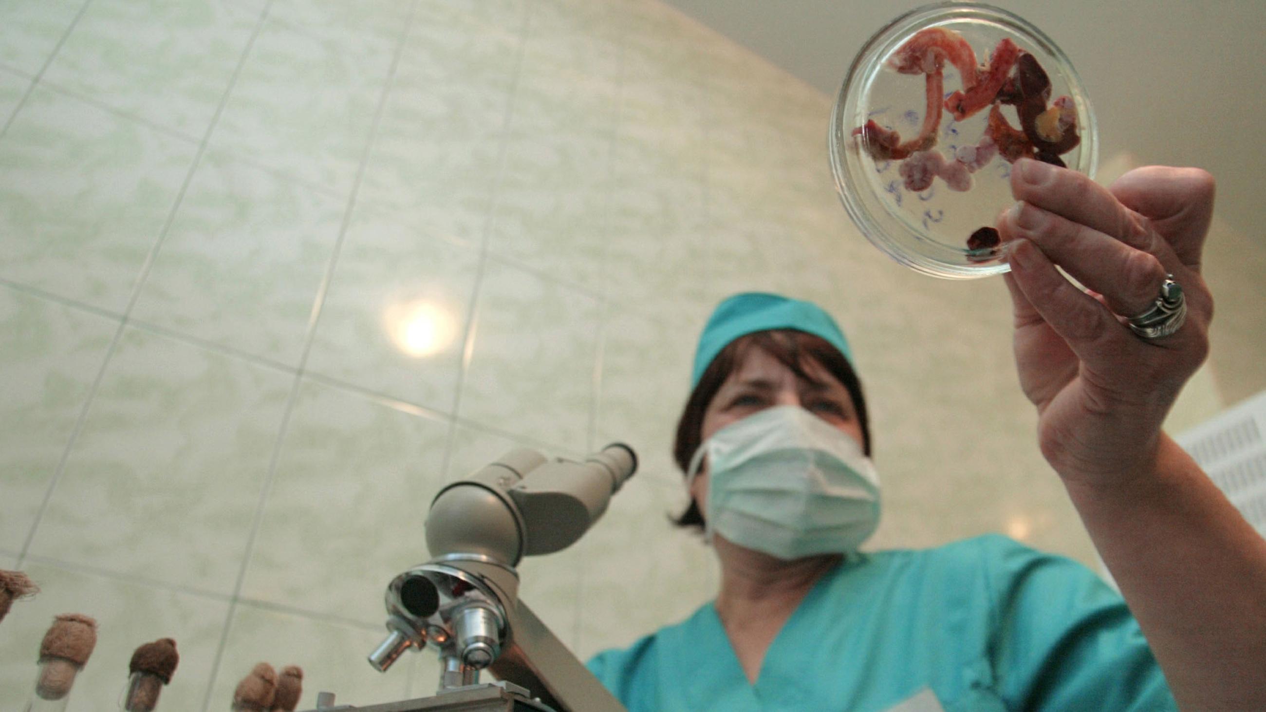 A laboratory worker holds samples of poultry entrails to test them for bird flu in a laboratory in the eastern Ukrainian city of Donetsk, on December 7, 2005