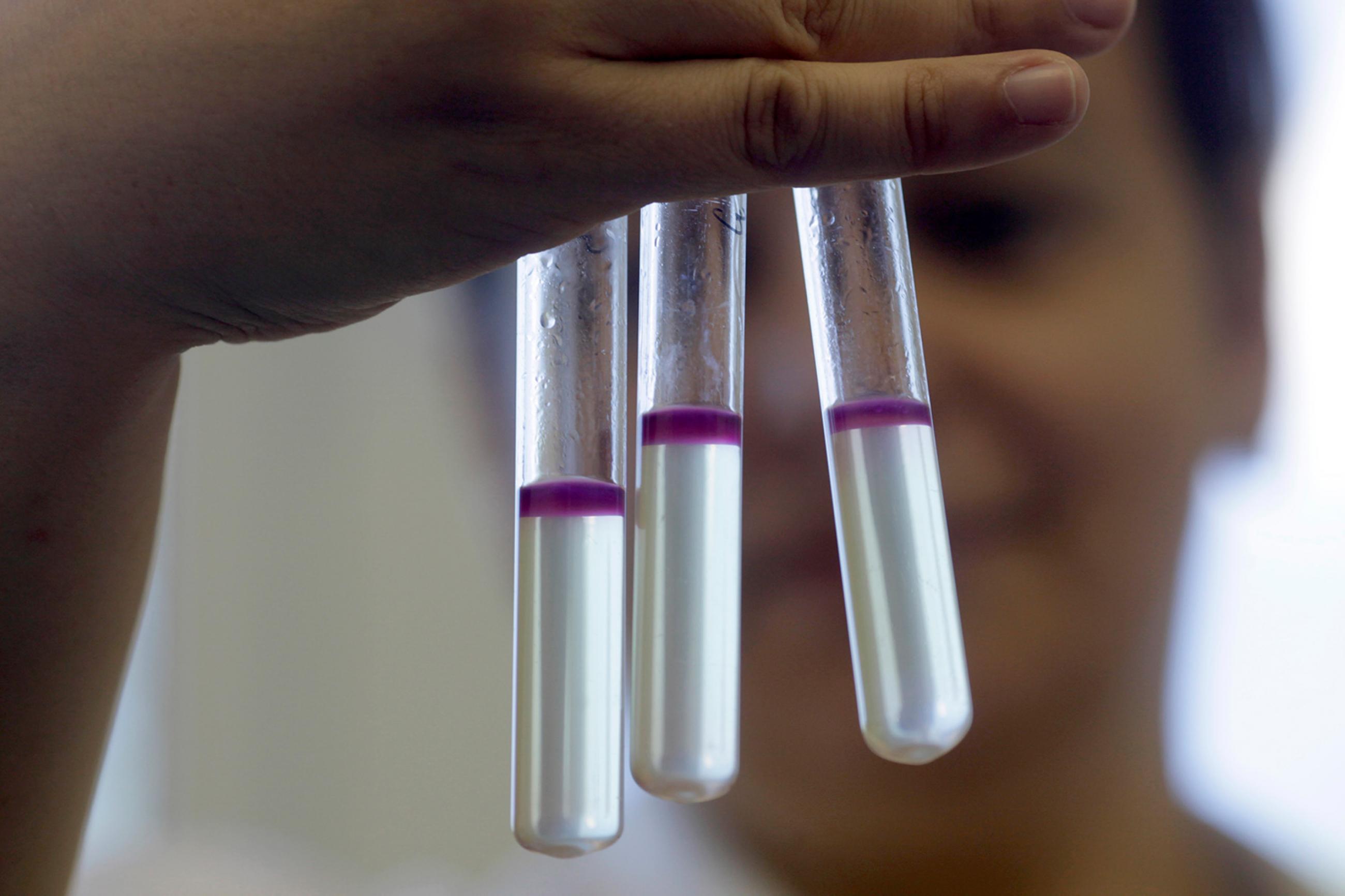 Researcher Marina Soloviecika holds tubes of a deadly strain of E.coli isolated during an outbreak in Riga, Latvia on June 9, 2011. Many other types of bacteria live safely in or on the human body. The image shows a few testtubes filled with liquid that has a very distinctive purple “lid.” The researcher can be seen blurred out in the background. REUTERS/Ints Kalnins
