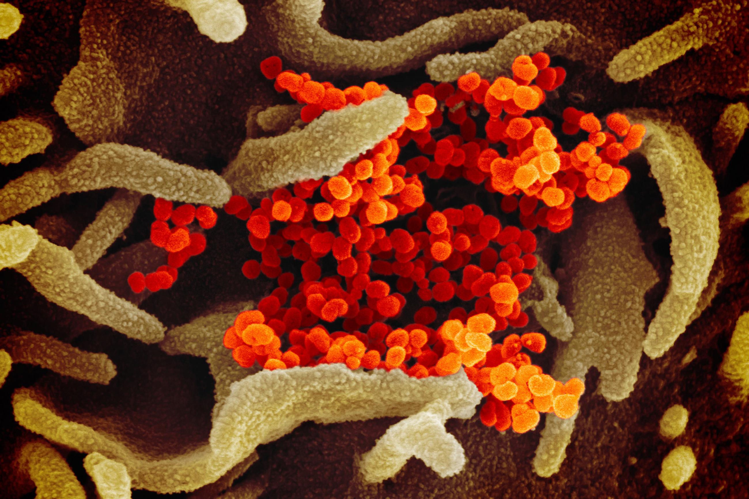A colorized scanning electron microscope image of the novel coronavirus SARS-CoV-2, also known as 2019-nCoV, which causes COVID-19. Image shows a colorful molecular world with a bunch of worm-like dendrites, presumably biological material like cells, and bright orange cluster of spheres in the middle of the image. NIAID-RML image