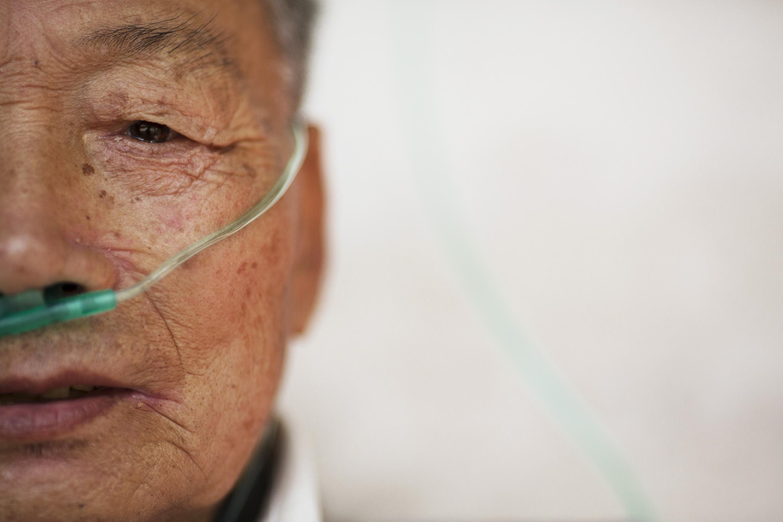 A close-up photo of the face of Hu Hushen, a 78-year-old former miner, who breathes with the help of extra oxygen at Yangjia Hospital in Zhejiang Province, China, on October 19, 2015.