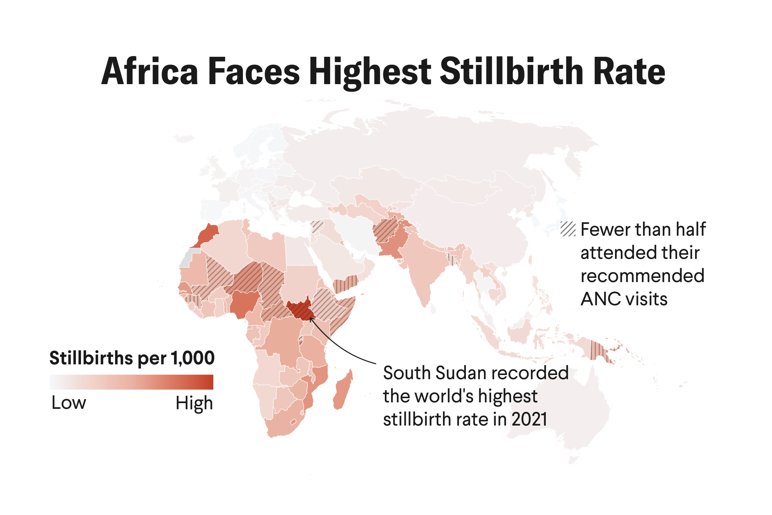 a gradient map showing where stillbirths are most common