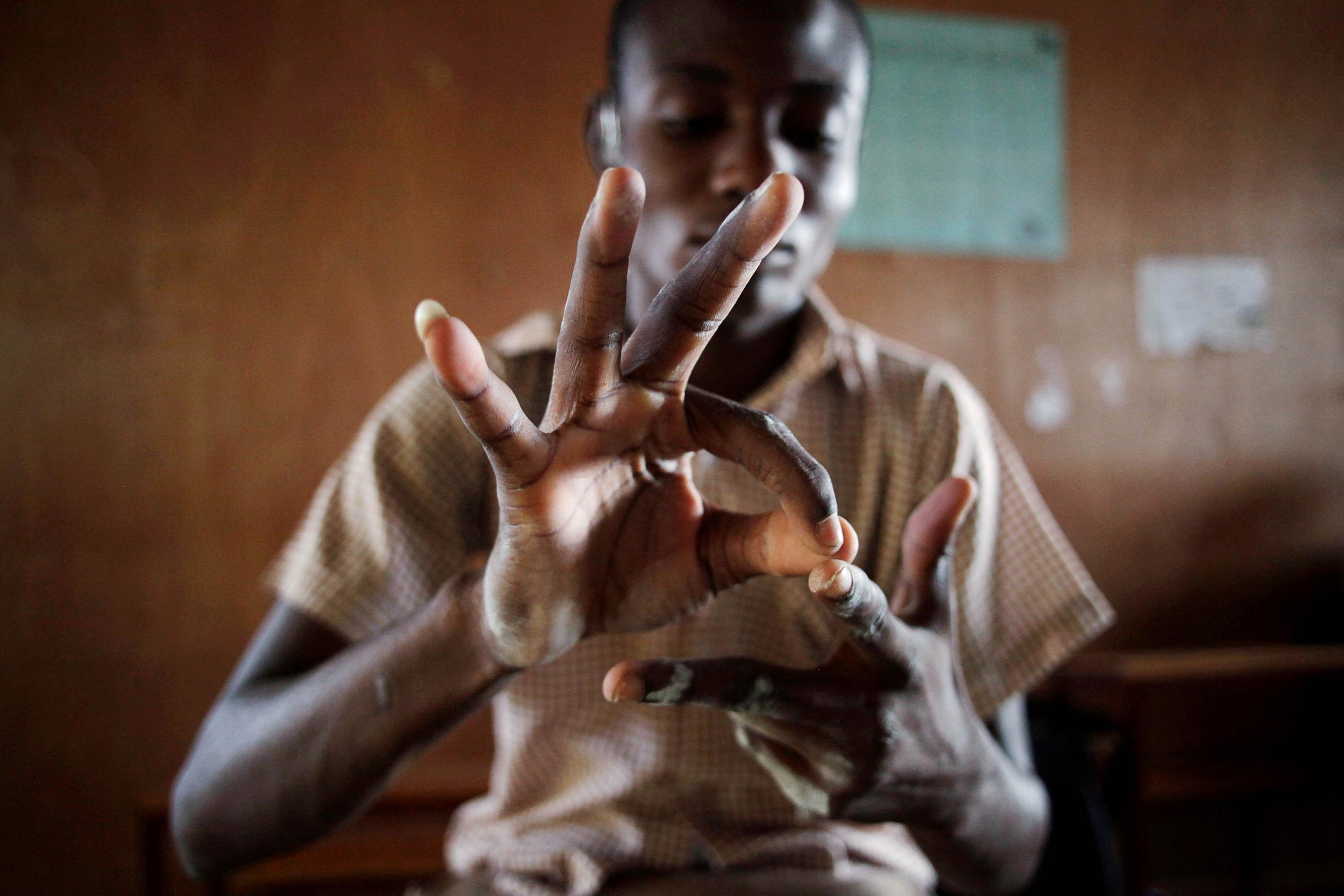 A deaf student counts numbers with his hands at the Mission de L'Espoir school, in Leveque, Haiti, on April 11, 2016.