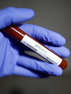 Photo shows a gloved hand holding a test tube labeled, “2019-nCoV” with two boxes ,marked “Positive” and “Negative.” The positive box is checked. 