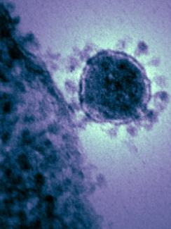  The image shows a purple-colored microscope image of a virus with a crown-like appearance. 