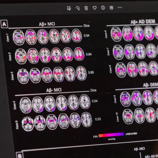 Driving Economic Gains Through Brain Capital