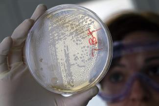 A laboratory worker looks for strains of E.coli bacteria in vegetable cells placed in a petri dish, in La Mojonera, Spain, on June 2, 2011
