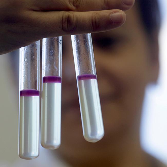 What are Microbiomes and Probiotics?