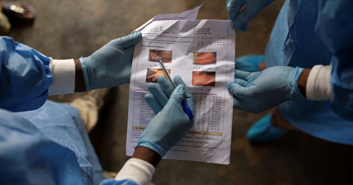 What South Africa’s Fatal Mpox Cases Mean for The Global Crisis